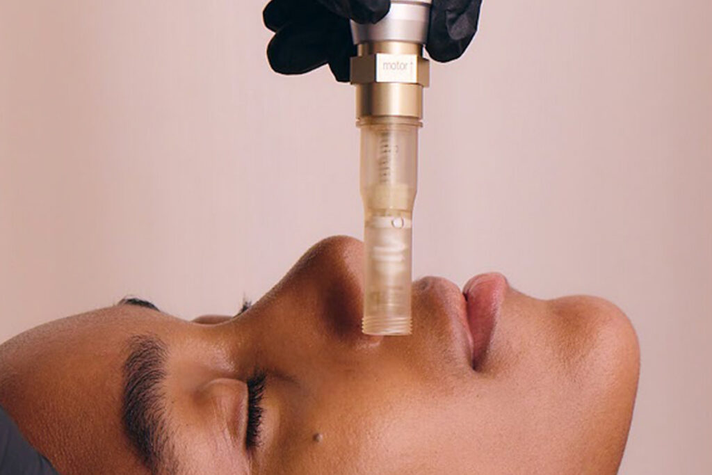 Salmon Sperm Facials: The Weird-Sounding Trend That Might Actually Work